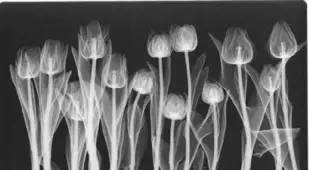 X-ray Art Negative