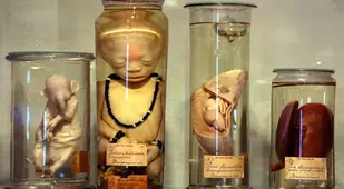 Weird Museums Boerhaave