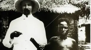 Congo Victim With No Hand