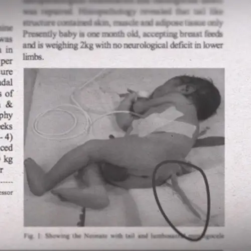 Video Of The Day: The Evidence Of Evolution You Can Find On Your Own Body