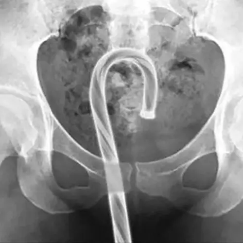 The 31 Most Ridiculous And Funny X-Ray Images You'll Ever See