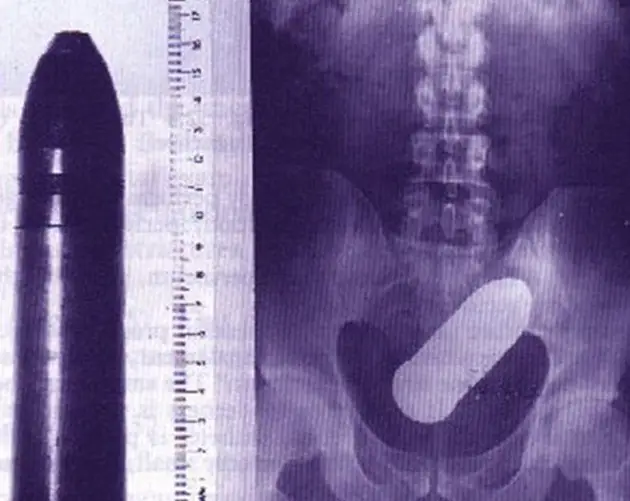 Funny X Rays Live Round