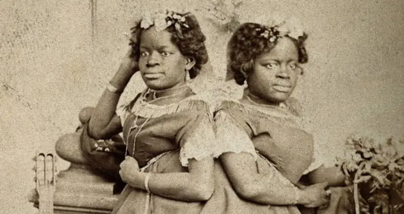 How The Conjoined McCoy Twins Beat The “Freak Show” System That Had Exploited Them