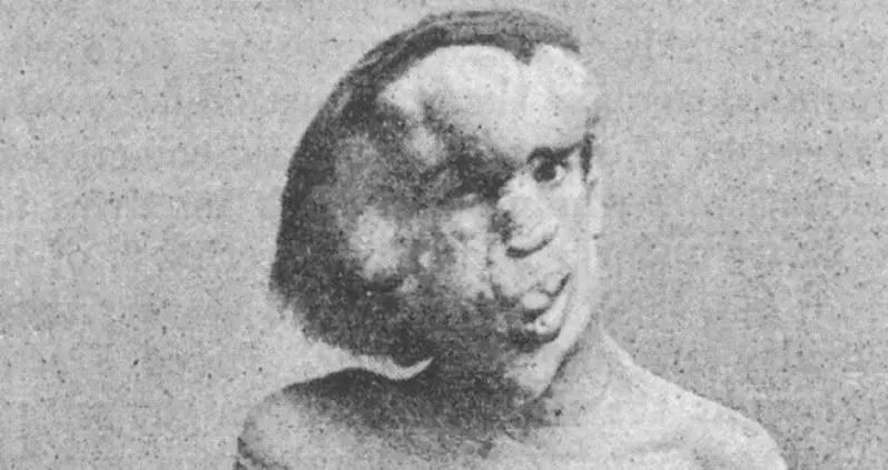 The Tragic Tale Of Joseph Merrick, ‘The Elephant Man’ Who Just Wanted To Be Like Everybody Else