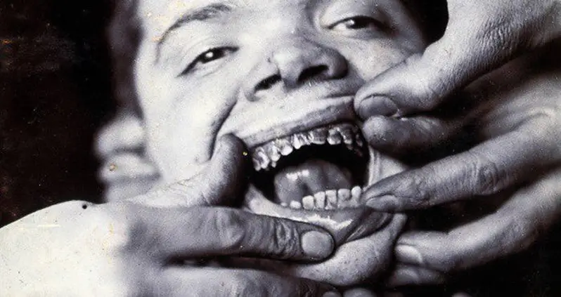 31 Creepy Pictures From The Early History Of Dentistry