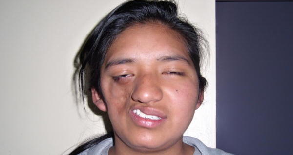 The Most Interesting Diseases To Have Ravaged Humanity