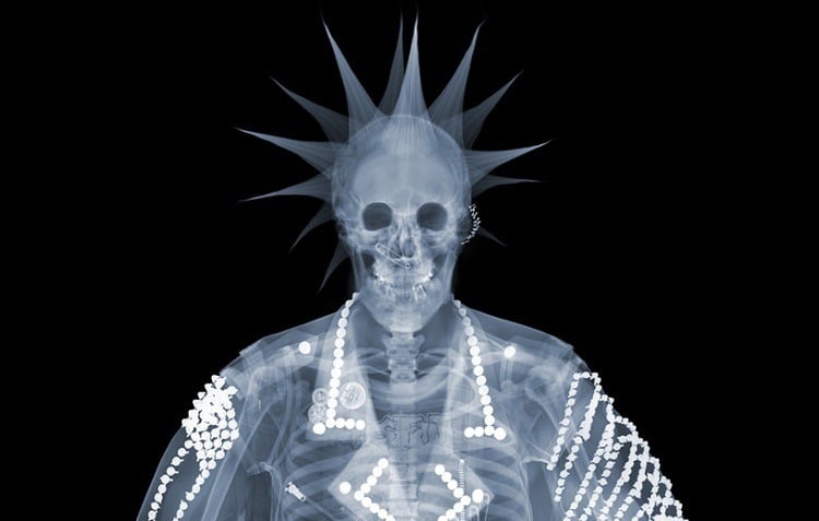 Oakland Raiders Fan X-Ray Photo