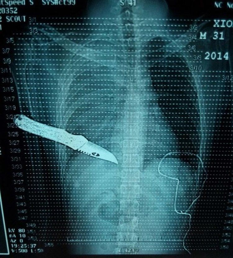 The 20 Weirdest X Rays Known To Humankind