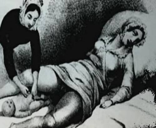 Midwife Birth