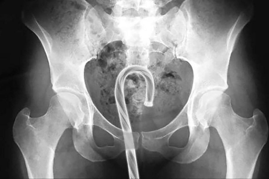 31 Funny X Ray Images That Seem Too Ridiculous To Be Real