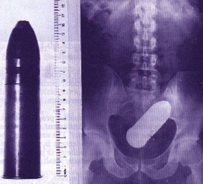 Funny X Ray Images That Seem Too Ridiculous To Be Real