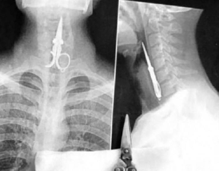 31 Funny X Ray Images That Seem Too Ridiculous To Be Real 