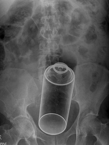 31 Funny X Ray Images That Seem Too Ridiculous To Be Real