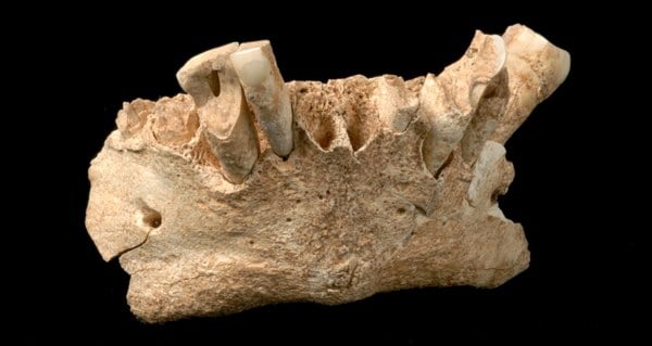 Why Cavemen S Teeth Were Healthier Than Ours