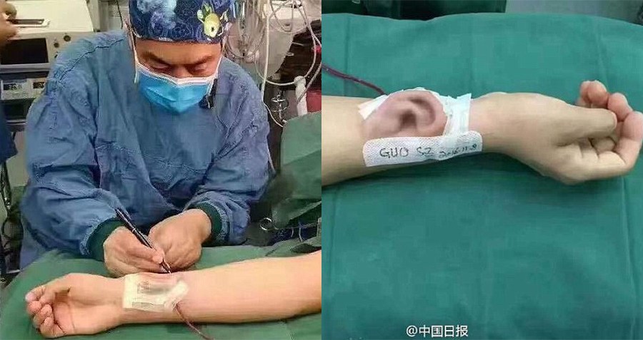 Chinese Ear Arm Og