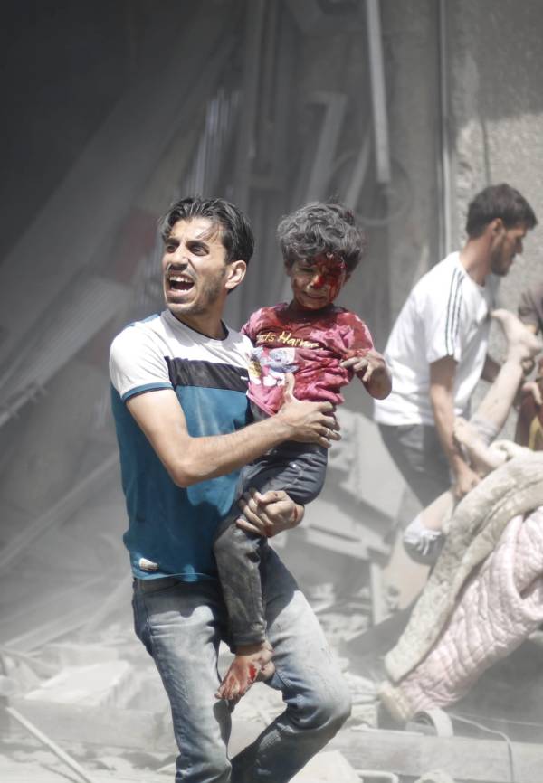 Syrian Man With Wounded Child