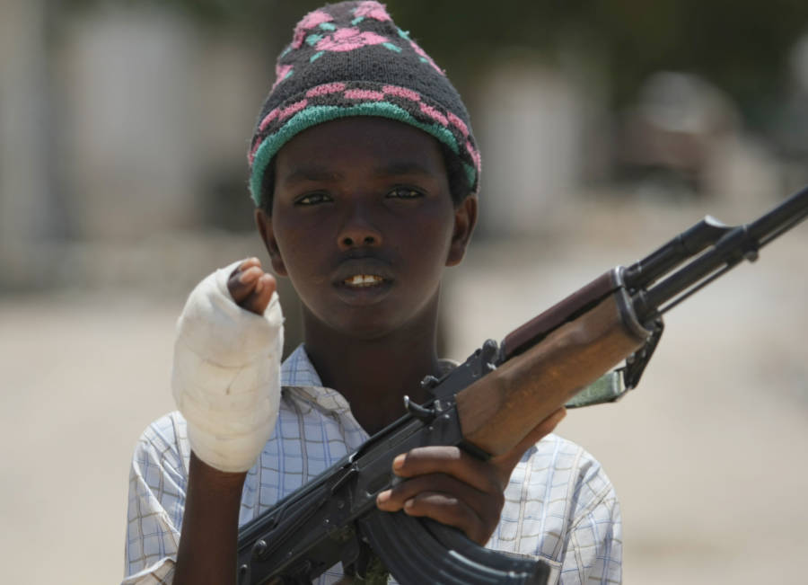 Wounded Child Soldier From Al Shabab