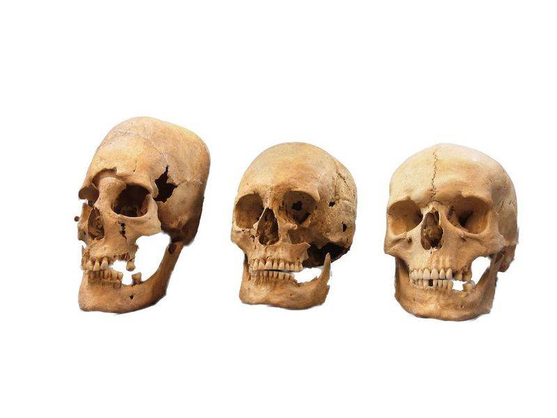 Elongated Skulls