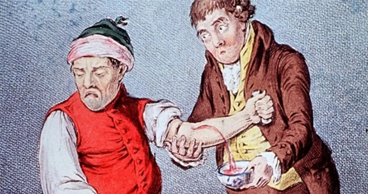 Leeches In Medicine History