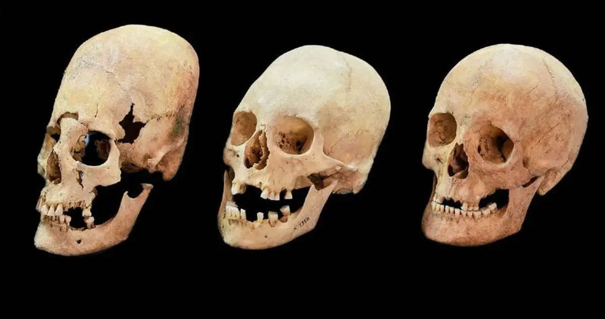 Ancient Cemetery With 51 Deformed Skulls Reveals Rome S Cultural Shifts