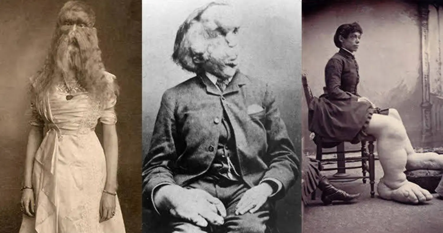 25 Tragic Photos From "Freak Shows" Of Decades Past