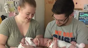 Conjoined Twins With Parents