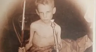 Starving Boy At Irene Camp