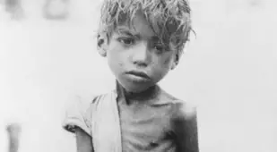 Starving Bengali child with an outstretched hand