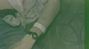 Kurt Cobain's Arm With Rehab Wristband