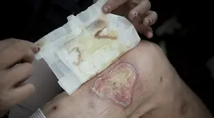 Krokodil Thigh Flesh