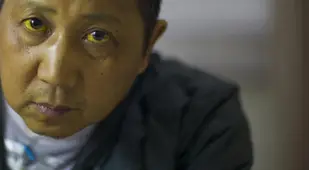 Chinese Cancer Villages Jaundice