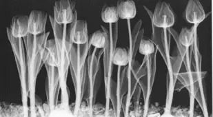 X-ray Art Negative