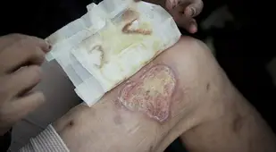 Krokodil Thigh Flesh