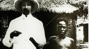 Congo Victim With No Hand