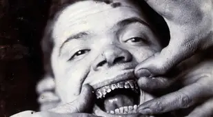 Terrifying Early Dentistry Pictures