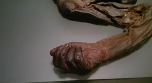Old Croughan Man Hand