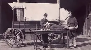 Civil War Amputation