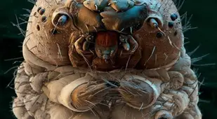 Electron Microscope Image