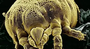 Scanning Electron Microscope Images