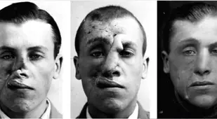 Beldam Before And After
