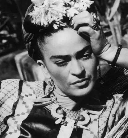 How Did Frida Kahlo Die