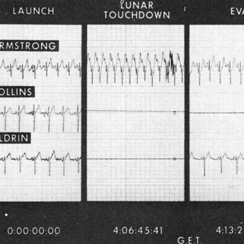 Neil Armstrong's Heart Rate During The Apollo 11 Mission