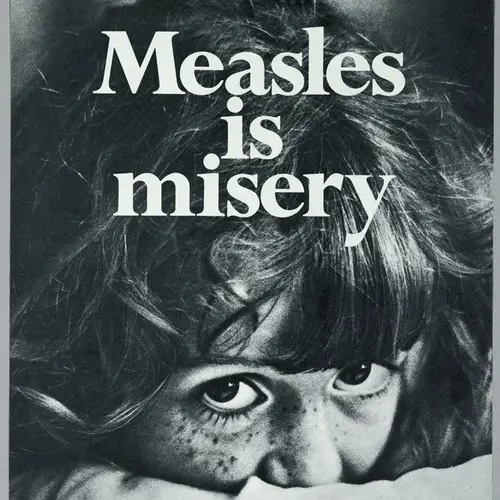 Why The History Of Measles (And Vaccines) Matters Today