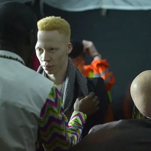 Albino Beauty Pageant Expands Definition Of Beauty