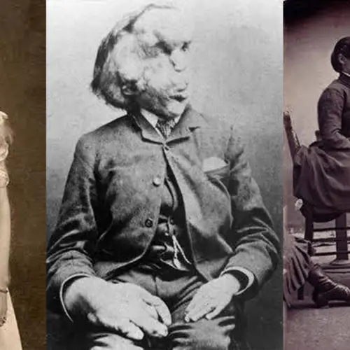 25 Photos Of "Freak Shows" That Are Thankfully A Thing Of The Past