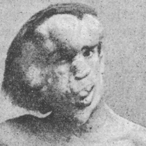The Tragic Tale Of Joseph Merrick, "The Elephant Man" Who Just Wanted To Be Like Everybody Else