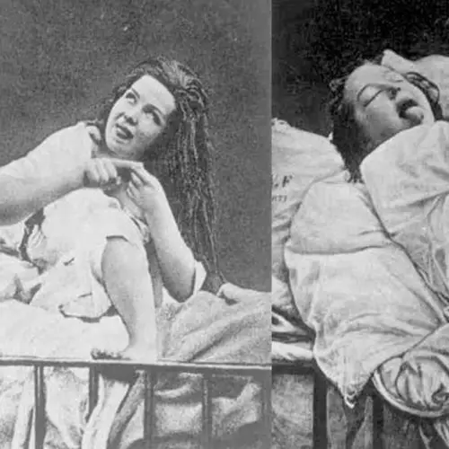 The History Of "Female Hysteria" And The Sex Toys Used To Treat It