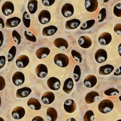 What Is Trypophobia? Inside A Surprisingly Common And Misunderstood Fear
