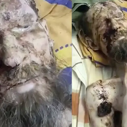 Man Mauled And 'Preserved As Food' By Bear Survives A Month In Its Den