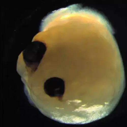 Tiny Lab-Grown Brains Sprout Functional, Rudimentary Human Eyes That Can See Light